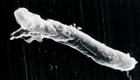 結核菌の電子顕微鏡写真