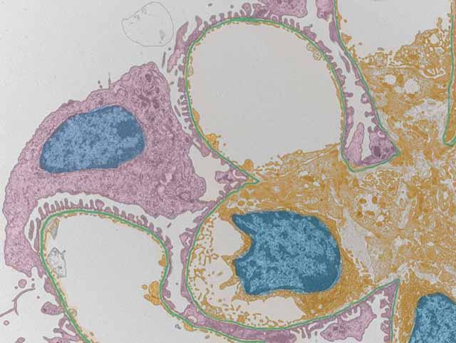 腎臓糸球体　透過型電子顕微鏡像