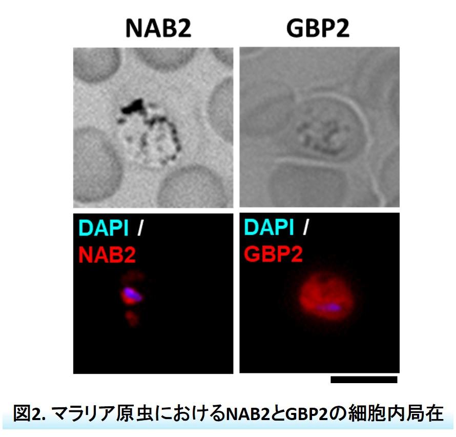 マラリア原虫におけるNAB2とGBP2の細胞内局在