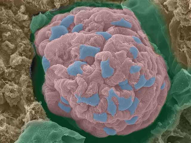 腎臓糸球体　走査型電子顕微鏡像