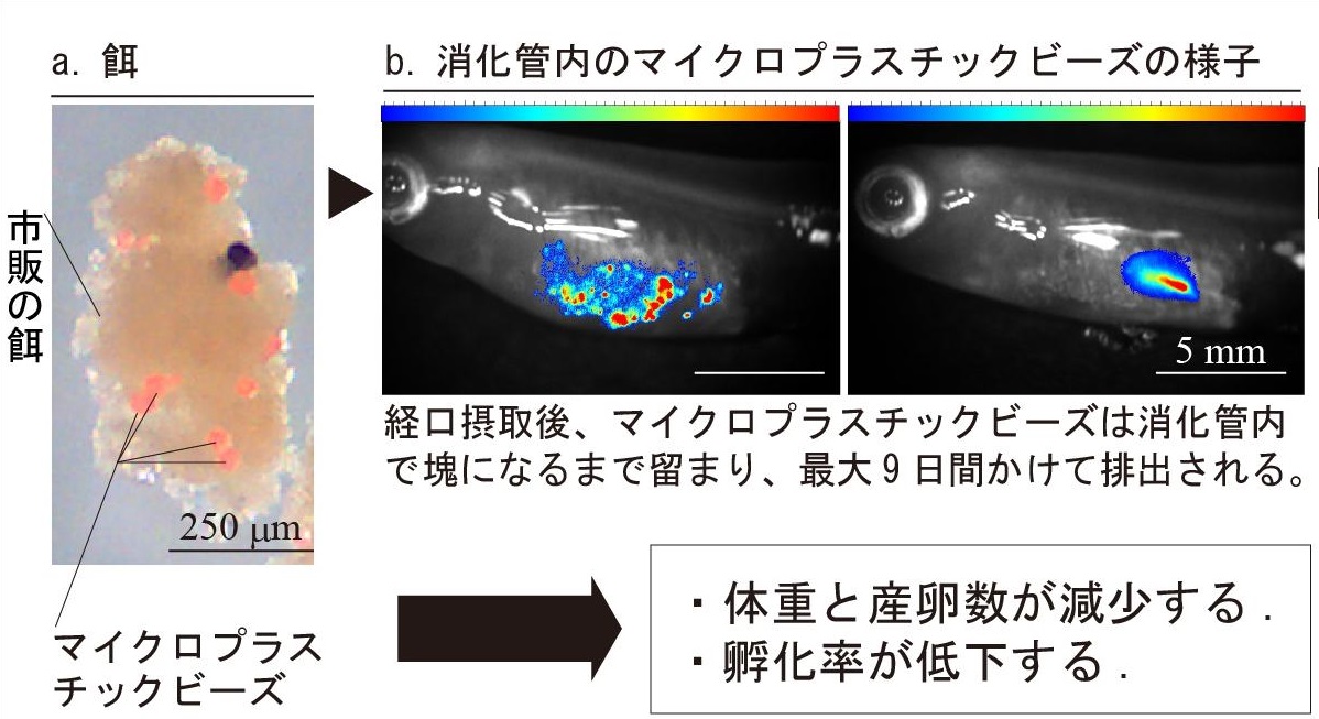 指定難病 自己免疫性肺胞蛋白症 の病因解明 新しい治療法を開発 研究 社会活動 杏林大学